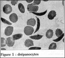 G n tique Et Biologie De La Dr panocytose Devsante