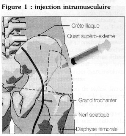 Injection intramusculaire · devsante.org