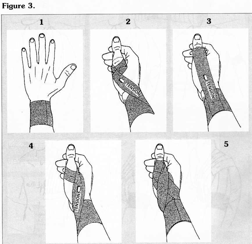 Comment réaliser un strapping pour une entorse du poignet ? - DrSport